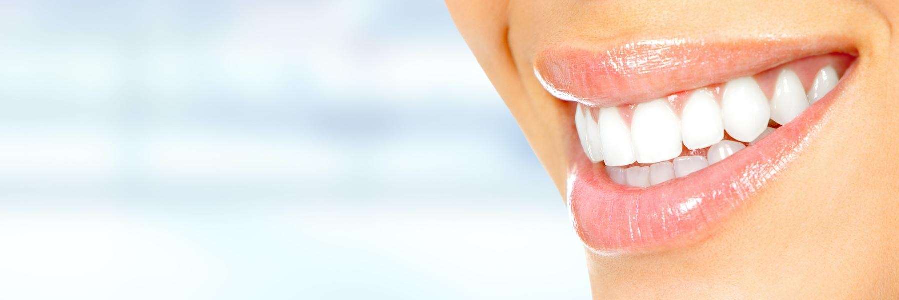 A woman smiling after getting a dental cleaning service in Boulder, CO