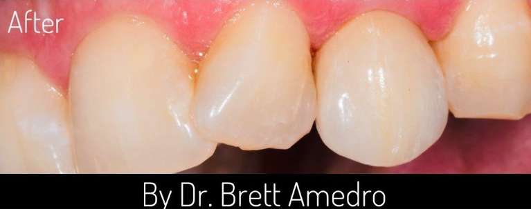 dentist in boulder