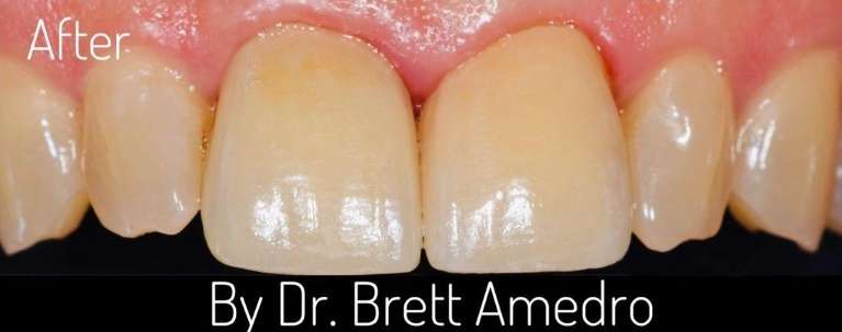 boulder co dentist