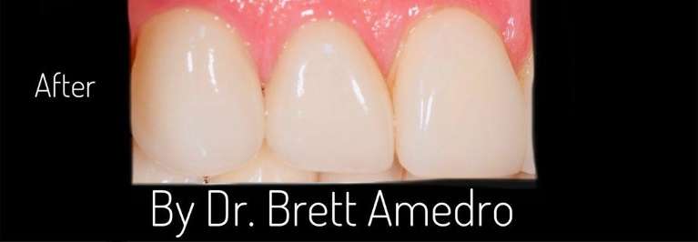 boulder dentist