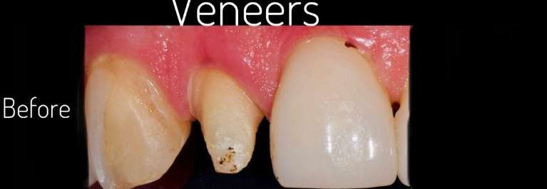dentist in boulder