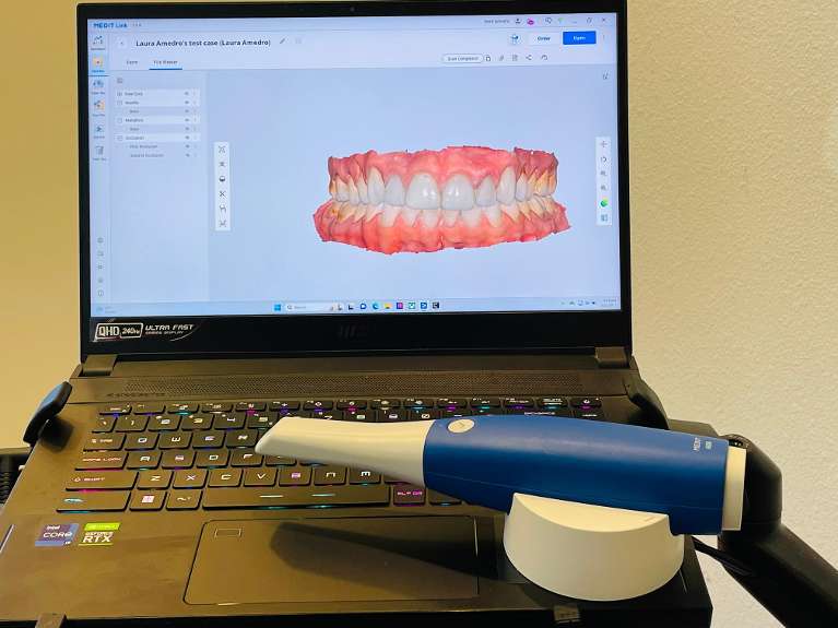 dental digital impressions in boulder